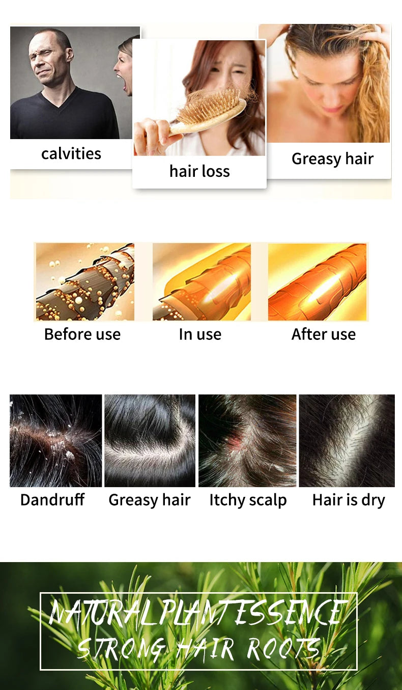 Shampoo sólido artesanal de árbol de té | Anticaspa y control de grasa