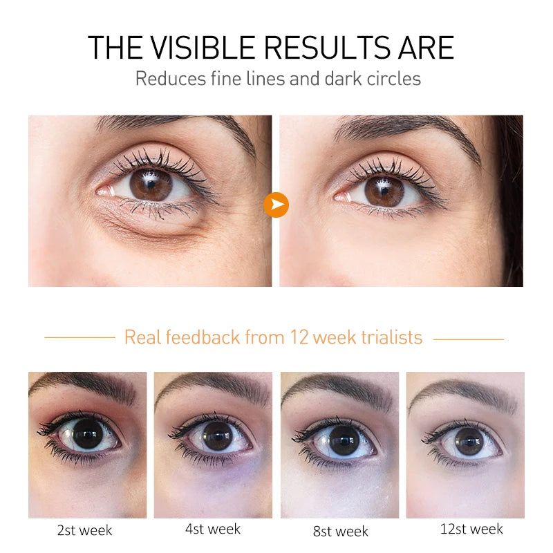 Crema de ojos O’CHEAL | Antiarrugas, ojeras y bolsas 30