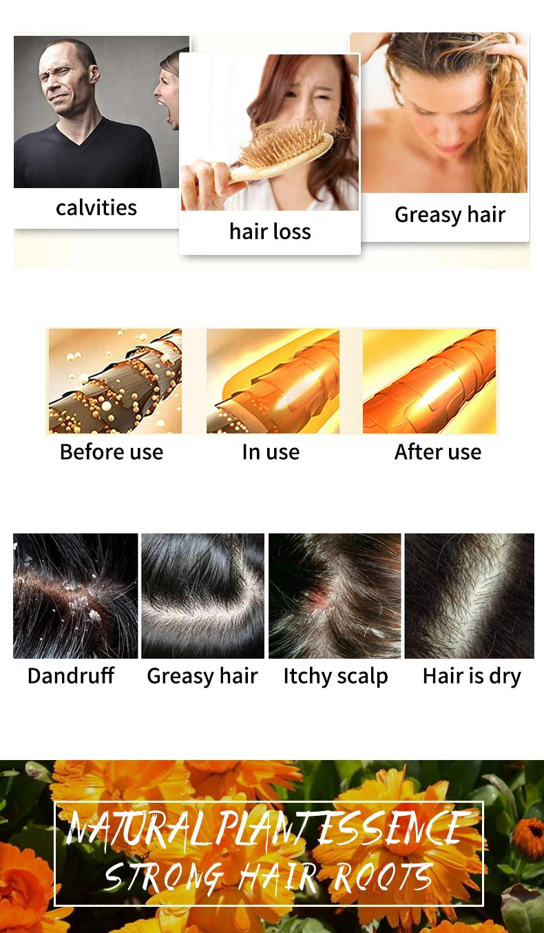 Shampoo sólido artesanal de caléndula | Limpieza profunda y control grasa