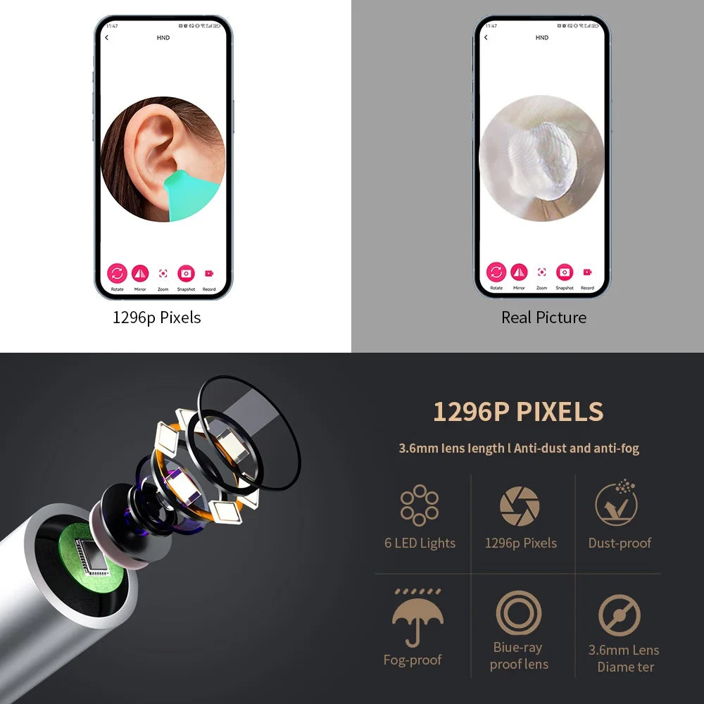 Limpiador de Oídos Inteligente 1296 P con Cámara y Wi-Fi – Earpick USB-C, 6 LED, Visualización en App