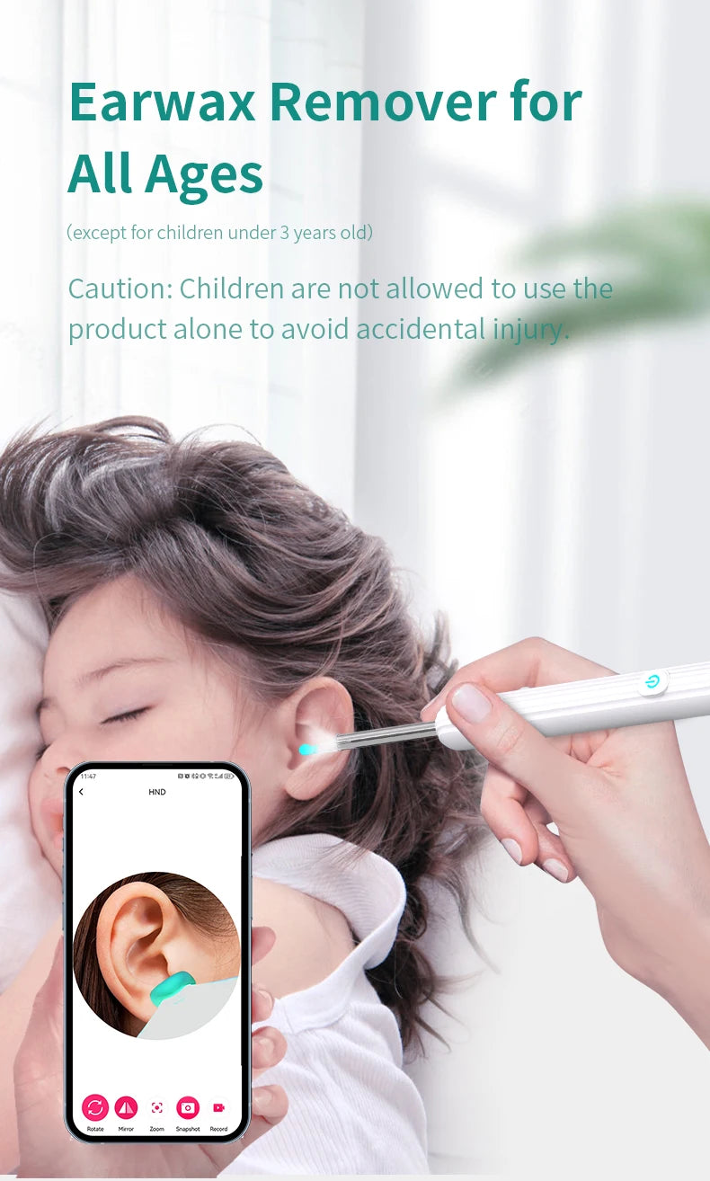 Limpiador de Oídos Inteligente 1296 P con Cámara y Wi-Fi – Earpick USB-C, 6 LED, Visualización en App