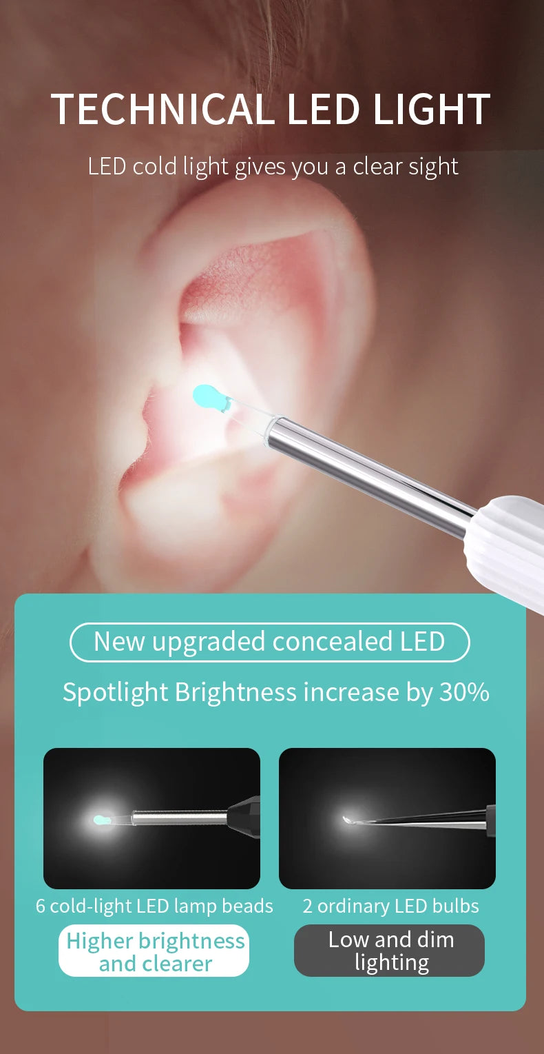 Limpiador de Oídos Inteligente 1296 P con Cámara y Wi-Fi – Earpick USB-C, 6 LED, Visualización en App